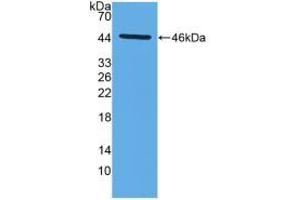 Western blot analysis of recombinant Mouse MMP14.