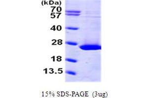 SDS-PAGE (SDS) image for ADP Ribosylation Factor Like GTPase 1 (ARL1) (AA 1-181) protein (His tag) (ABIN667171)