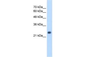 Western Blotting (WB) image for anti-Nicotinamide N-Methyltransferase (NNMT) antibody (ABIN2462559) (NNMT anticorps)