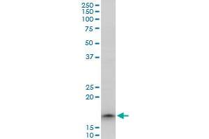 TOMM22 polyclonal antibody (A01), Lot # 051206JC01.