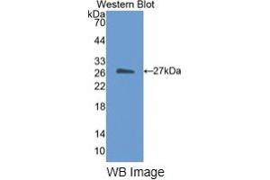 WB of Protein Standard: different control antibodies against Highly purified E. (CETP Kit ELISA)