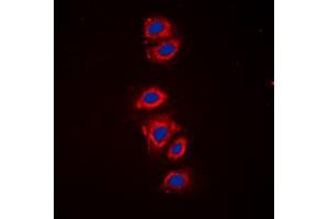 Immunofluorescent analysis of RPS6 (pS240) staining in HeLa cells. (RPS6 anticorps  (C-Term, pSer240))