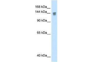 TP53BP2 antibody used at 1. (TP53BP2 anticorps  (N-Term))