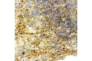 Anti-Caspase-6(P18) antibody,  IHC(F) IHC(F): Rat Spleen Tissue