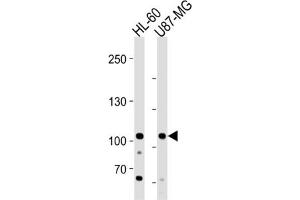 Western Blotting (WB) image for anti-MORC Family CW-Type Zinc Finger 3 (MORC3) antibody (ABIN3004591)