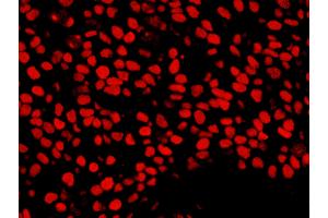 Immunofluorescence (IF) image for anti-Nuclear Mitotic Apparatus Protein 1 (NUMA1) (AA 900-950) antibody (ABIN7453400)