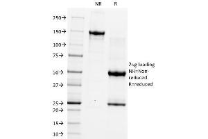 SDS-PAGE Analysis Purified CD5 Monoclonal Antibody (CRIS-1).