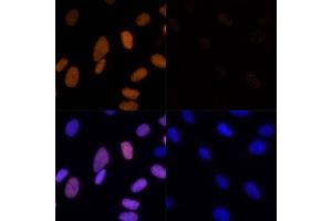 Immunofluorescence analysis of U-2 OS cells using Acetyl-Histone H3-K23 (ABIN7267669) at dilution of 1:100.