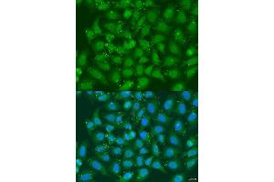 Immunofluorescence analysis of U2OS cells using XBP1 antibody. (XBP1 anticorps  (AA 1-261))