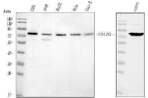 Western blot analysis of Caldesmon using anti-Caldesmon antibody (ABIN4886498). (Caldesmon anticorps  (AA 1-120))