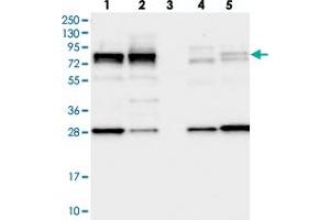 Western blot analysis of Lane 1: RT-4, Lane 2: U-251 MG, Lane 3: Human Plasma, Lane 4: Liver, Lane 5: Tonsil with LSG1 polyclonal antibody  at 1:250-1:500 dilution.
