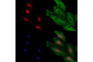 ABIN7094659 and ABIN7098710 staining  cells by IF/ICC. (TCF21 anticorps  (Internal Region))