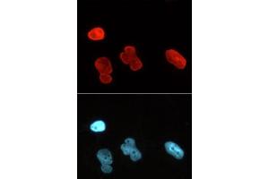 Lamin A/C mAb (Clone 3A6-4C11) tested by immunofluorescence.