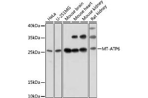 Western blot analysis of extracts of various cell lines, using MT- antibody (ABIN7268592) at 1:1000 dilution. (MT-ATP6 anticorps)