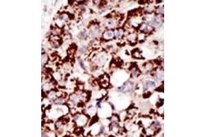 Image no. 2 for anti-GPI-anchor transamidase (GPI8) (C-Term) antibody (ABIN357726) (PIGK anticorps  (C-Term))