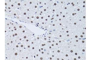 Immunohistochemistry of paraffin-embedded rat liver using PCNA antibody (ABIN5970094) at dilution of 1/100 (40x lens). (PCNA anticorps)