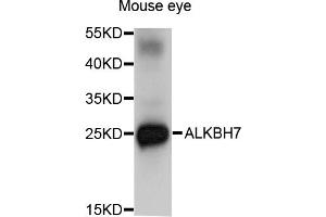 Western blot analysis of extracts of mouse eye, using ALKBH7 antibody (ABIN5971299) at 1/1000 dilution. (ALKBH7 anticorps)
