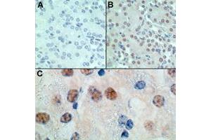 Image no. 1 for anti-Msh Homeobox 1 (MSX1) (AA 50-100) antibody (ABIN207744)