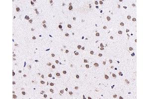 Immunohistochemistry analysis of paraffin-embedded mouse brain using c-Fos Monoclonal Antibody at dilution of 1:1000.