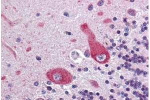 Brain, cerebellum, Human: Formalin-Fixed, Paraffin-Embedded (FFPE) (Ankyrin G anticorps  (AA 1690-1701))