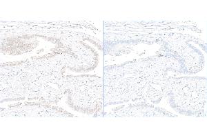 anti-gamma Histone Variant H2AX (GAMMA-H2AX) (Ser140) antibody