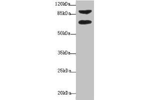 Western blot All lanes: DTX2 antibody at 1 μg/mL + HepG2 whole cell lysate Secondary Goat polyclonal to rabbit IgG at 1/10000 dilution Predicted band size: 68, 63 kDa Observed band size: 68, 92 kDa (DTX2 anticorps  (AA 1-280))