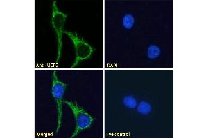 ABIN5539644 Immunofluorescence analysis of paraformaldehyde fixed MCF7 cells, permeabilized with 0.
