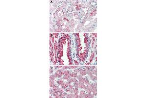Immunohistochemical staining of formalin-fixed, paraffin-embedded human kidney (A), human prostate (B) and human liver (C) tissue after heat-induced antigen retrieval. (GPR146 anticorps  (Internal Region))