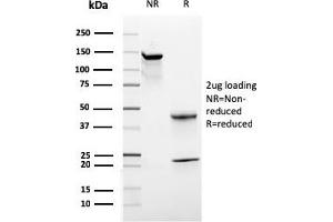SDS-PAGE Analysis Purified CD44 Recombinant Mouse Monoclonal Antibody (rHCAM/918).