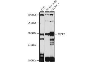 Western blot analysis of extracts of various cell lines, using SYCP2 antibody (ABIN7270668) at 1:1000 dilution.