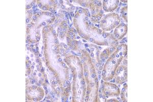 Immunohistochemistry of paraffin-embedded rat kidney using ACAA1 antibody (ABIN4902819) at dilution of 1:100 (40x lens). (ACAA1 anticorps)