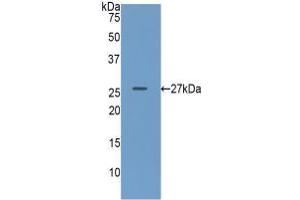Western blot analysis of recombinant Human GUSb. (Glucuronidase beta anticorps  (AA 451-649))