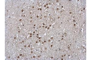 IHC-P Image LIMD1 antibody [C2C3], C-term detects LIMD1 protein at nucleus on mouse brain by immunohistochemical analysis. (LIMD1 anticorps  (C-Term))
