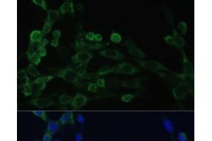 Immunofluorescence analysis of NIH/3T3 cells using EEF1B2 Polyclonal Antibody at dilution of 1:100. (EEF1B2 anticorps)