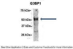 Amount and Sample Type :  500 ug rat brain homogenate  Amount of IP Antibody :  6 ug  Primary Antibody :  G3BP1  Primary Antibody Dilution :  1:500  Secondary Antibody :  Goat anti-rabbit Alexa-Fluor 594  Secondary Antibody Dilution :  1:5000  Gene Name :  G3BP1  Submitted by :  Dr.
