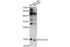 Western blot analysis of extracts of various cell lines, using FAM127A antibody. (CXX1 anticorps)