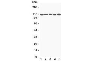 Western blot testing of C5a antibody and Lane 1:  rat liver