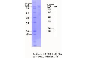 Western Blotting (WB) image for Cadherin 12 (AA 55-609) protein (MBP tag) (ABIN3090213)