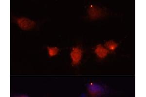 Immunofluorescence analysis of U-251MG cells using NPY Polyclonal Antibody at dilution of 1:100 (40x lens). (NPY anticorps)