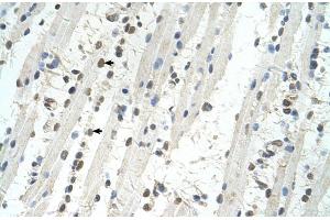 Human Muscle (TRIM32 anticorps  (C-Term))
