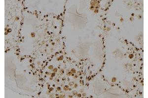 ABIN6264614 and ABIN6277485 at 1/100 staining Human lung tissue by IHC-P. (RAD23A anticorps  (C-Term))