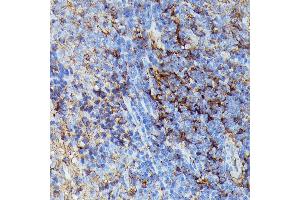 Immunohistochemistry of paraffin-embedded rat spleen using HLA-B antibody (ABIN1513015, ABIN3021868, ABIN3021869 and ABIN6216628) at dilution of 1:100 (40x lens).