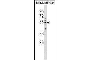 Western blot analysis in MDA-MB231 cell line lysates (35ug/lane). (HTRA4 anticorps  (AA 283-311))