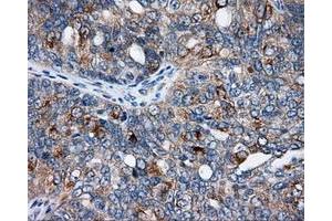 Immunohistochemical staining of paraffin-embedded Kidney tissue using anti-SIL1 mouse monoclonal antibody. (SIL1 anticorps)