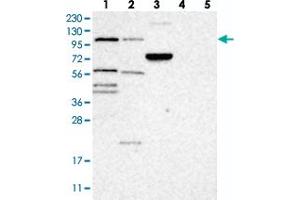 Western blot analysis of Lane 1: RT-4, Lane 2: U-251 MG, Lane 3: Human Plasma, Lane 4: Liver, Lane 5: Tonsil with TTLL4 polyclonal antibody . (TTLL4 anticorps)