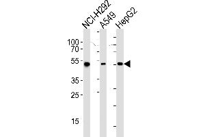 Western blot analysis of lysates from NCI-, A549, HepG2 cell line (from left to right), using ALDH2 Antibody (ABIN658993 and ABIN2838036). (ALDH2 anticorps)