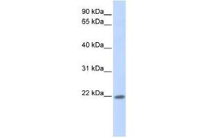 Western Blot showing ZNF534 antibody used at a concentration of 1-2 ug/ml to detect its target protein. (ZNF534 anticorps  (Middle Region))