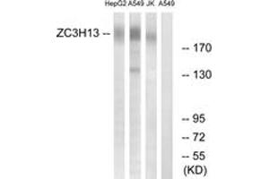 Western blot analysis of extracts from A549/Jurkat/HepG2 cells, using ZC3H13 Antibody. (ZC3H13 anticorps  (AA 1571-1620))
