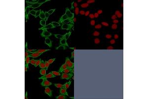 Confocal Immunofluorescence of HeLa cells.