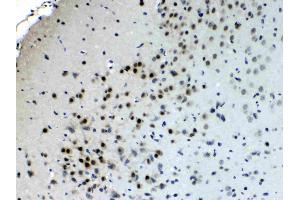 IHC analysis of CHAT using anti- CHAT antibody .